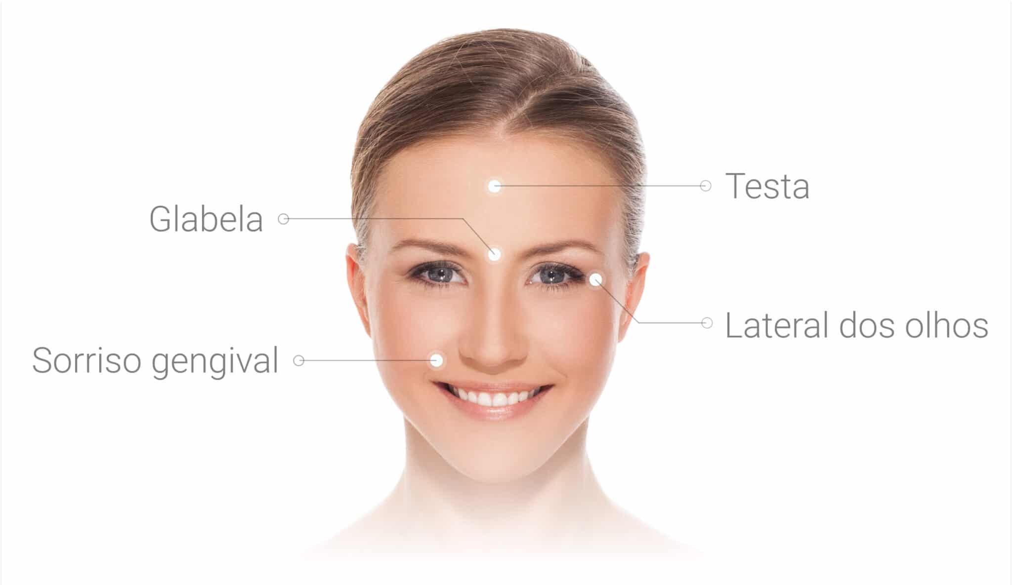 Um rosto de mulher com as palavras "Glabela", "Testa", "Sorriso gengival" e "Lateral dos Olhos" esquematicamente dispostas ao redor de suas feições.